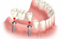 dentistas em juiz de fora
