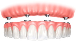 dentistas em juiz de fora