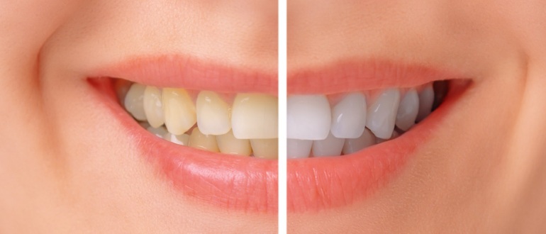 dentistas em juiz de fora