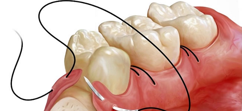dentistas em juiz de fora