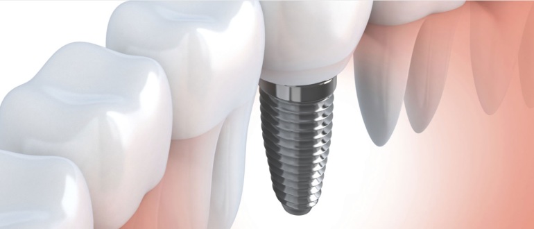 dentistas em juiz de fora